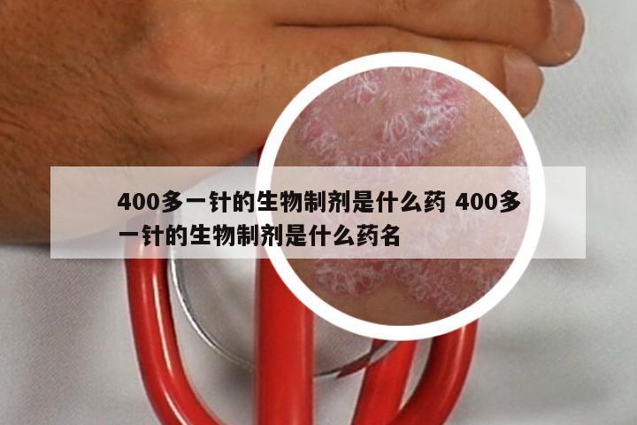 400多一针的生物制剂是什么药 400多一针的生物制剂是什么药名