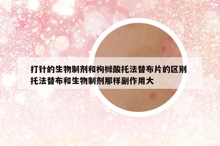 打针的生物制剂和枸橼酸托法替布片的区别 托法替布和生物制剂那样副作用大