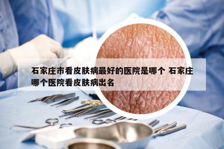 石家庄市看皮肤病最好的医院是哪个 石家庄哪个医院看皮肤病出名