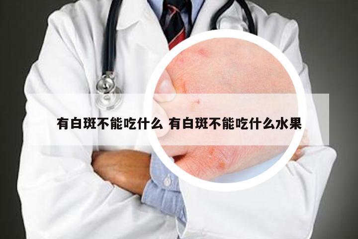 有白斑不能吃什么 有白斑不能吃什么水果