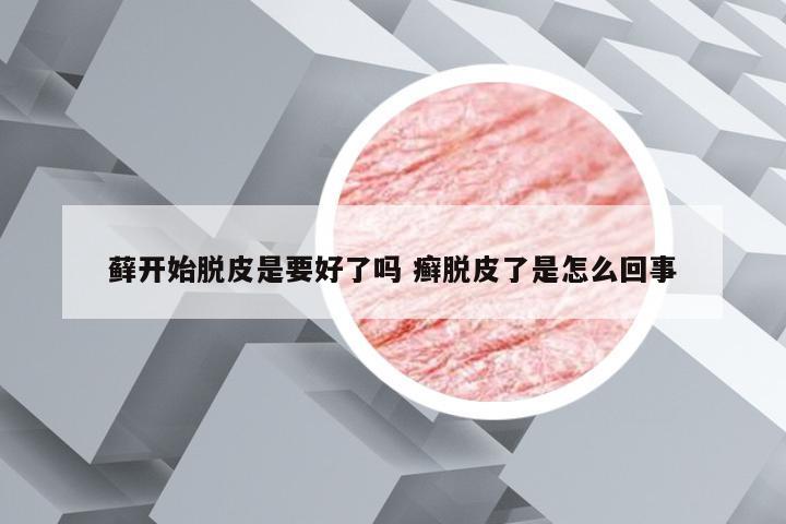 藓开始脱皮是要好了吗 癣脱皮了是怎么回事