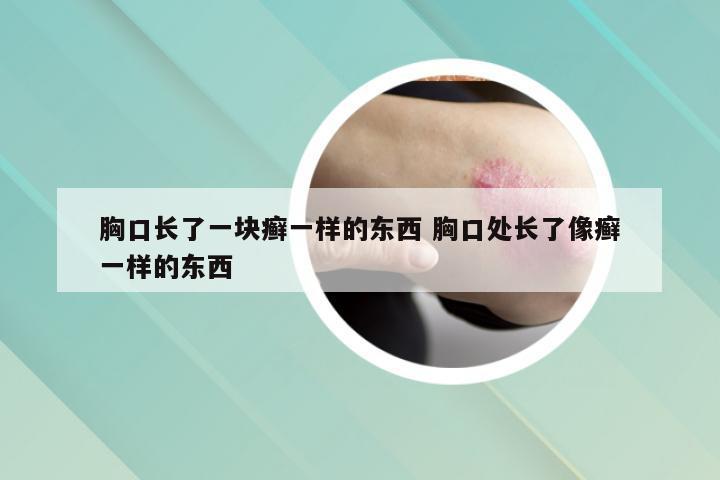 胸口长了一块癣一样的东西 胸口处长了像癣一样的东西