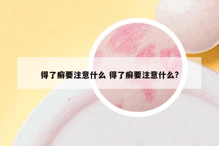 得了癣要注意什么 得了癣要注意什么?