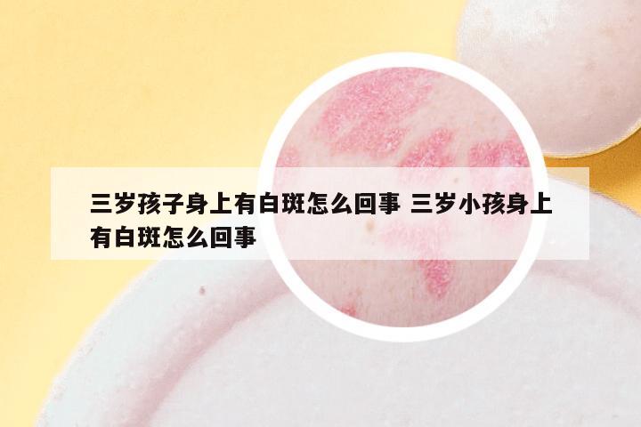 三岁孩子身上有白斑怎么回事 三岁小孩身上有白斑怎么回事