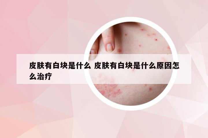 皮肤有白块是什么 皮肤有白块是什么原因怎么治疗