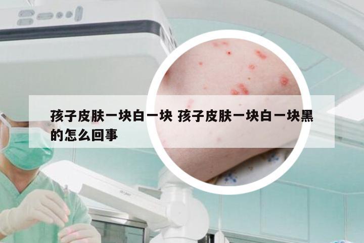 孩子皮肤一块白一块 孩子皮肤一块白一块黑的怎么回事