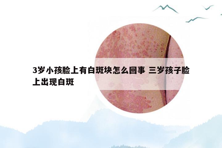 3岁小孩脸上有白斑块怎么回事 三岁孩子脸上出现白斑