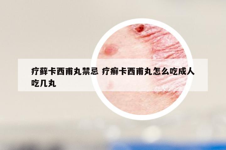 疗藓卡西甫丸禁忌 疗癣卡西甫丸怎么吃成人吃几丸