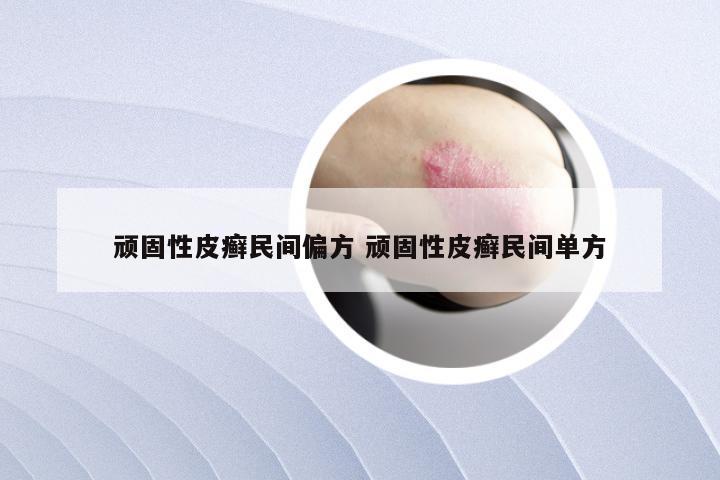 顽固性皮癣民间偏方 顽固性皮癣民间单方