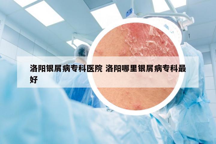 洛阳银屑病专科医院 洛阳哪里银屑病专科最好