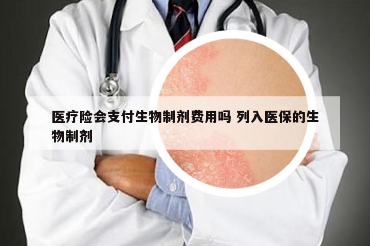 医疗险会支付生物制剂费用吗 列入医保的生物制剂
