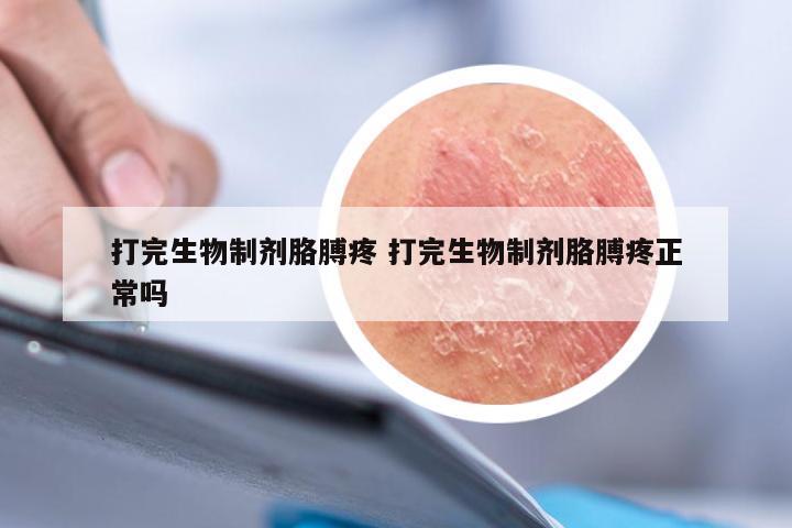 打完生物制剂胳膊疼 打完生物制剂胳膊疼正常吗