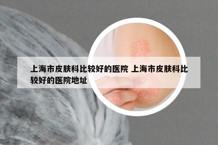 上海市皮肤科比较好的医院 上海市皮肤科比较好的医院地址