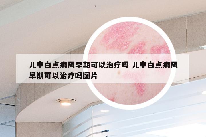 儿童白点癫风早期可以治疗吗 儿童白点癫风早期可以治疗吗图片