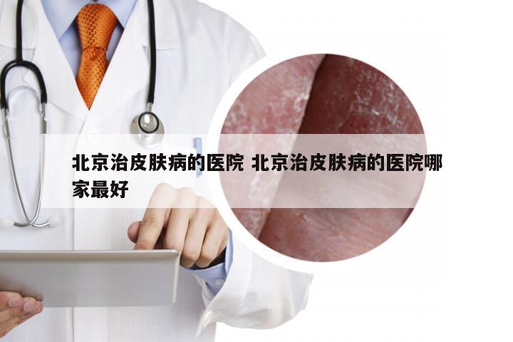 北京治皮肤病的医院 北京治皮肤病的医院哪家最好