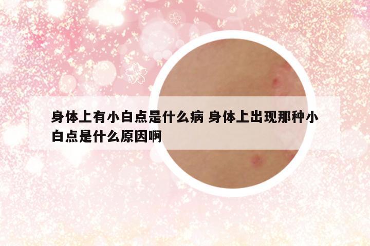 身体上有小白点是什么病 身体上出现那种小白点是什么原因啊