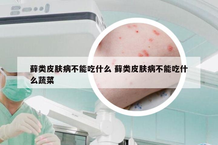 藓类皮肤病不能吃什么 藓类皮肤病不能吃什么蔬菜