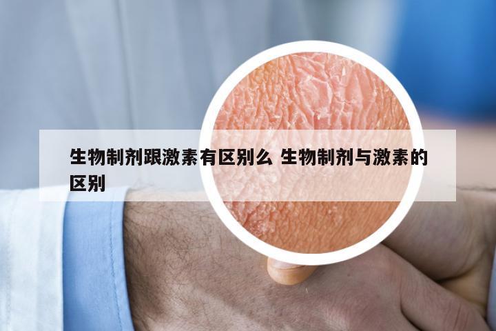 生物制剂跟激素有区别么 生物制剂与激素的区别