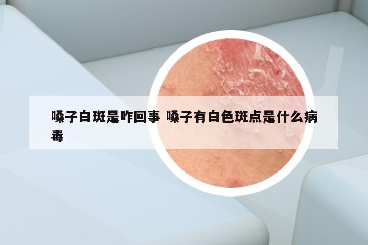 嗓子白斑是咋回事 嗓子有白色斑点是什么病毒