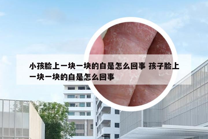 小孩脸上一块一块的白是怎么回事 孩子脸上一块一块的白是怎么回事