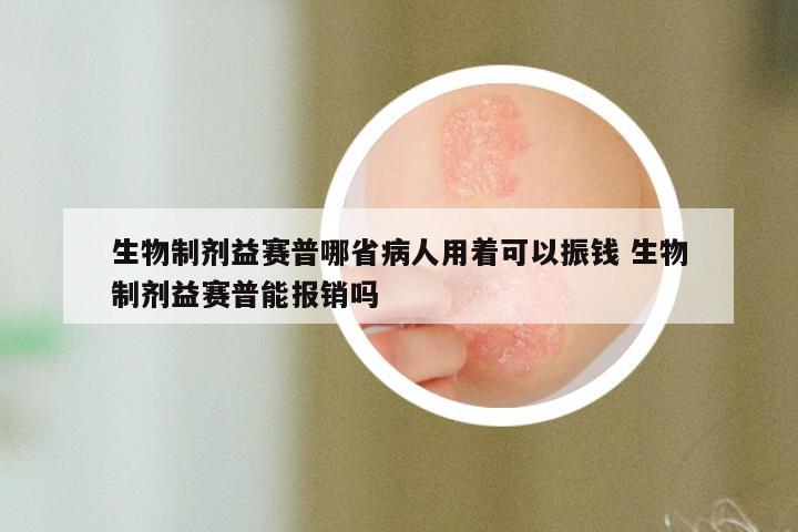 生物制剂益赛普哪省病人用着可以振钱 生物制剂益赛普能报销吗