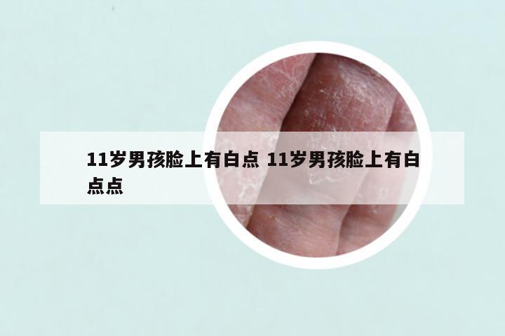 11岁男孩脸上有白点 11岁男孩脸上有白点点