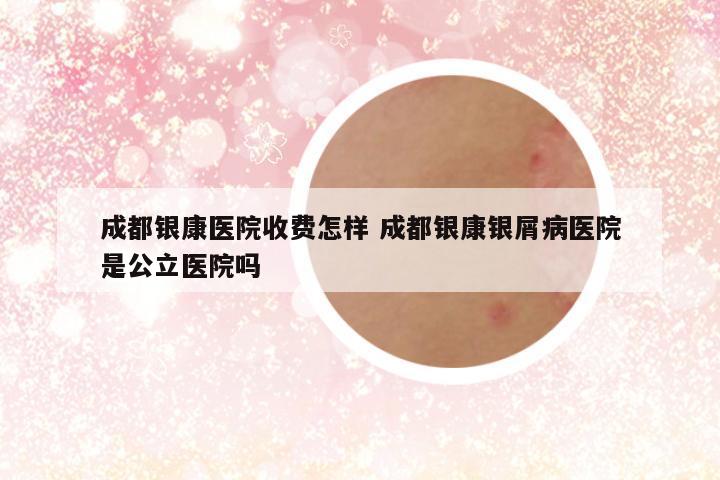成都银康医院收费怎样 成都银康银屑病医院是公立医院吗
