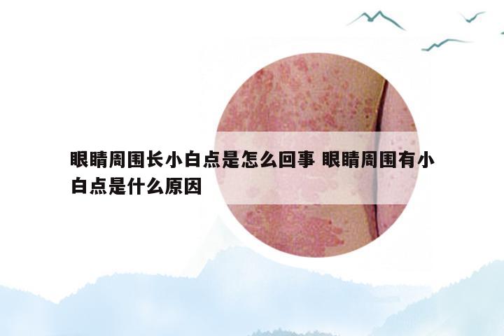 眼睛周围长小白点是怎么回事 眼睛周围有小白点是什么原因