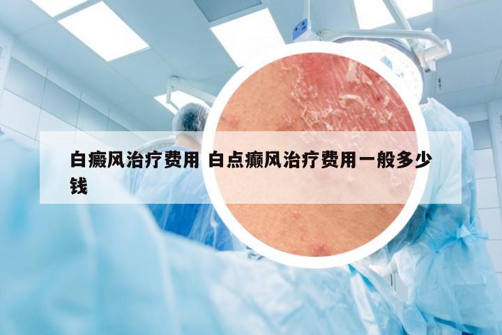 白癜风治疗费用 白点癫风治疗费用一般多少钱