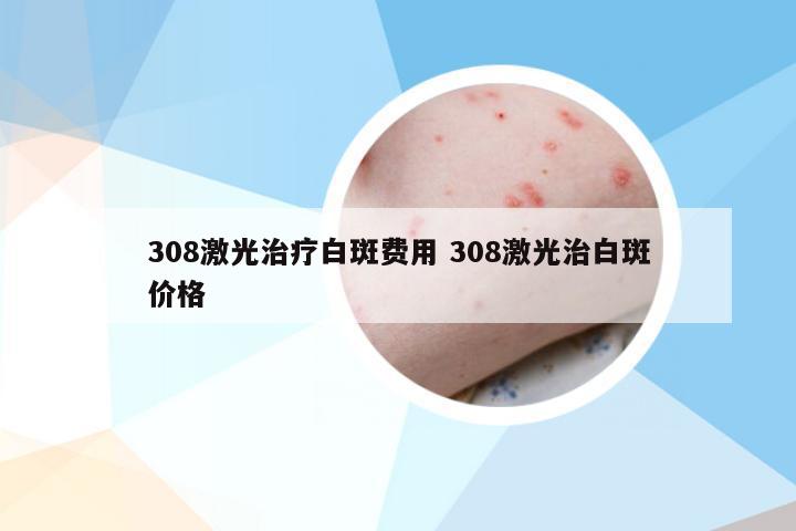 308激光治疗白斑费用 308激光治白斑价格