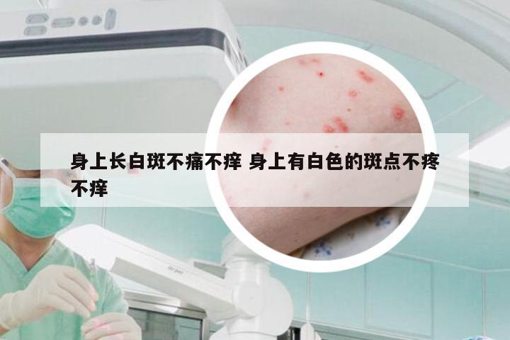 身上长白斑不痛不痒 身上有白色的斑点不疼不痒