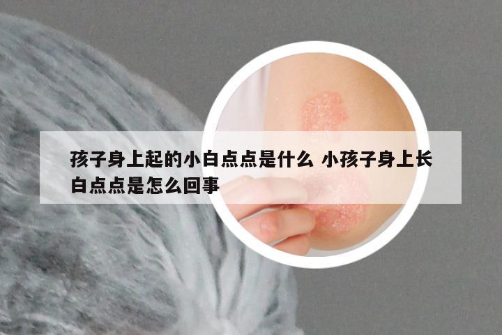 孩子身上起的小白点点是什么 小孩子身上长白点点是怎么回事