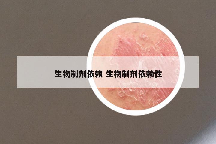 生物制剂依赖 生物制剂依赖性