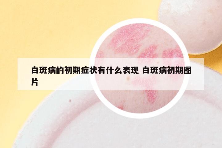 白斑病的初期症状有什么表现 白斑病初期图片