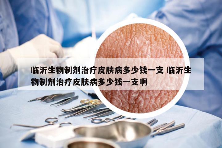 临沂生物制剂治疗皮肤病多少钱一支 临沂生物制剂治疗皮肤病多少钱一支啊
