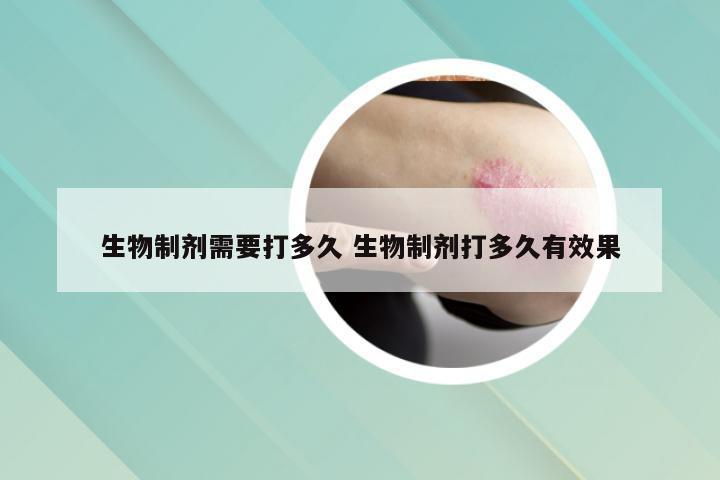 生物制剂需要打多久 生物制剂打多久有效果