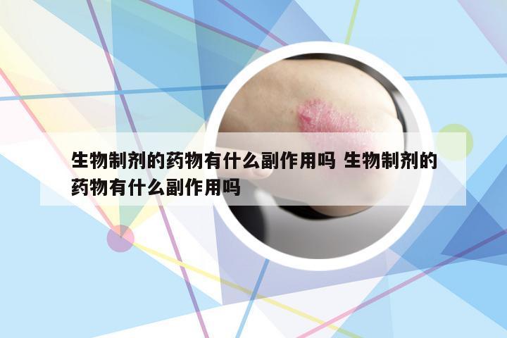 生物制剂的药物有什么副作用吗 生物制剂的药物有什么副作用吗