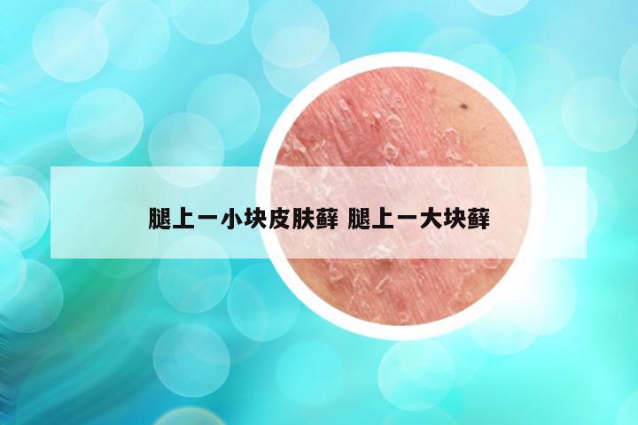 腿上一小块皮肤藓 腿上一大块藓