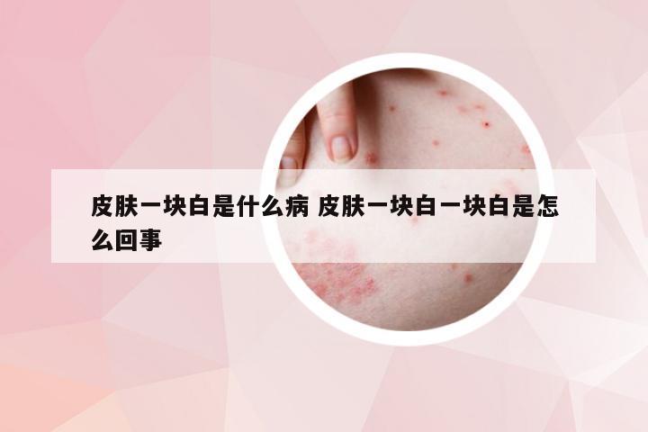 皮肤一块白是什么病 皮肤一块白一块白是怎么回事