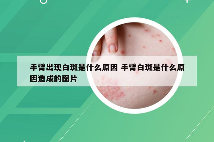 手臂出现白斑是什么原因 手臂白斑是什么原因造成的图片