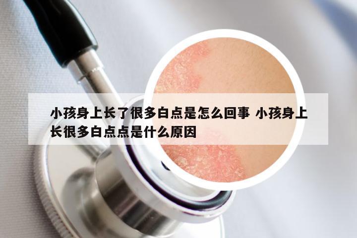 小孩身上长了很多白点是怎么回事 小孩身上长很多白点点是什么原因