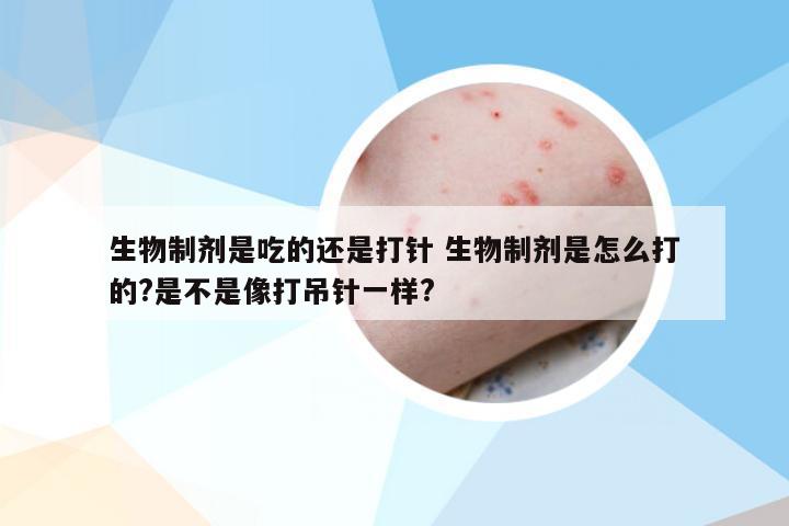 生物制剂是吃的还是打针 生物制剂是怎么打的?是不是像打吊针一样?