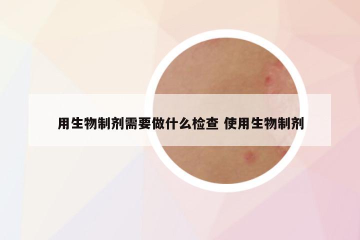 用生物制剂需要做什么检查 使用生物制剂