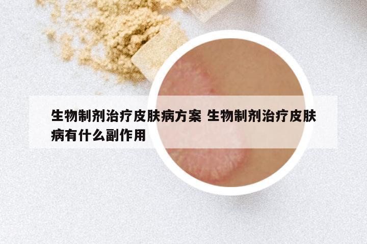 生物制剂治疗皮肤病方案 生物制剂治疗皮肤病有什么副作用