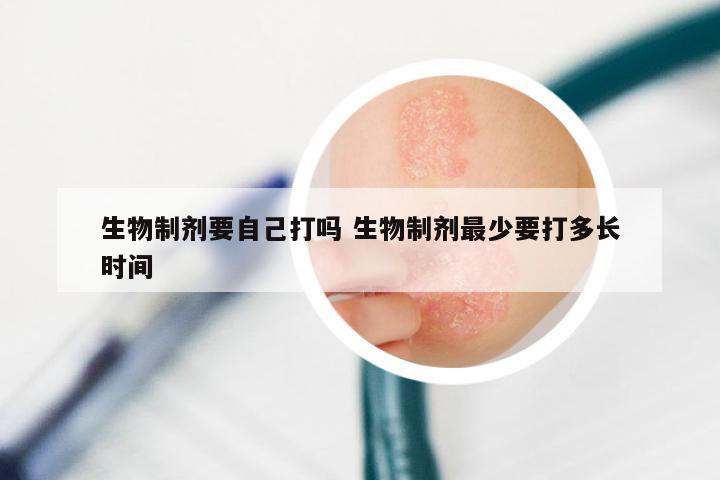 生物制剂要自己打吗 生物制剂最少要打多长时间