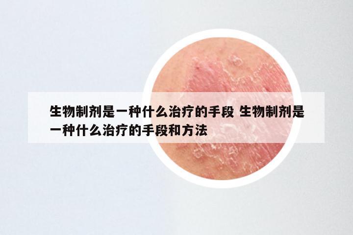 生物制剂是一种什么治疗的手段 生物制剂是一种什么治疗的手段和方法