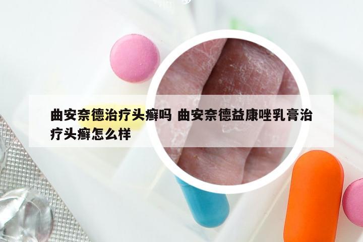曲安奈德治疗头癣吗 曲安奈德益康唑乳膏治疗头癣怎么样