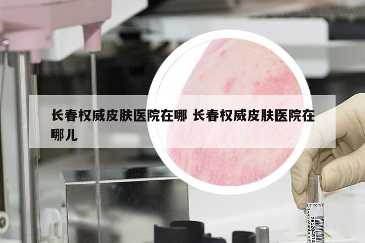 长春权威皮肤医院在哪 长春权威皮肤医院在哪儿