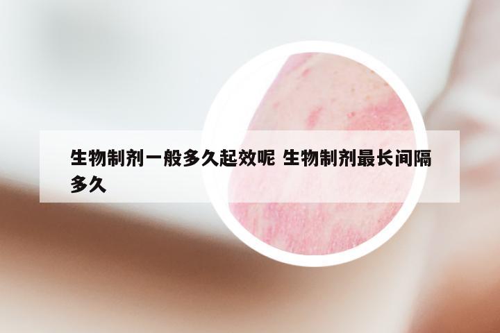 生物制剂一般多久起效呢 生物制剂最长间隔多久