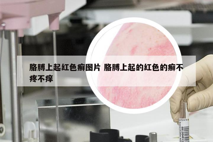 胳膊上起红色癣图片 胳膊上起的红色的癣不疼不痒